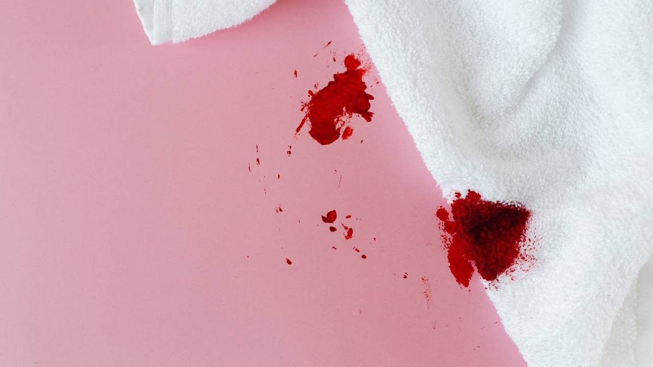 Sonhar com manchas de sangue