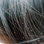 Sonhar com lêndea: quais são os significados?