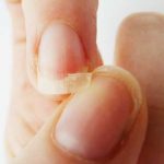 Sonhar com unha quebrada: o que isso quer dizer? Leia aqui!