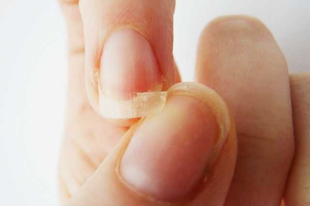 Sonhar com unha quebrada: o que isso quer dizer? Leia aqui!